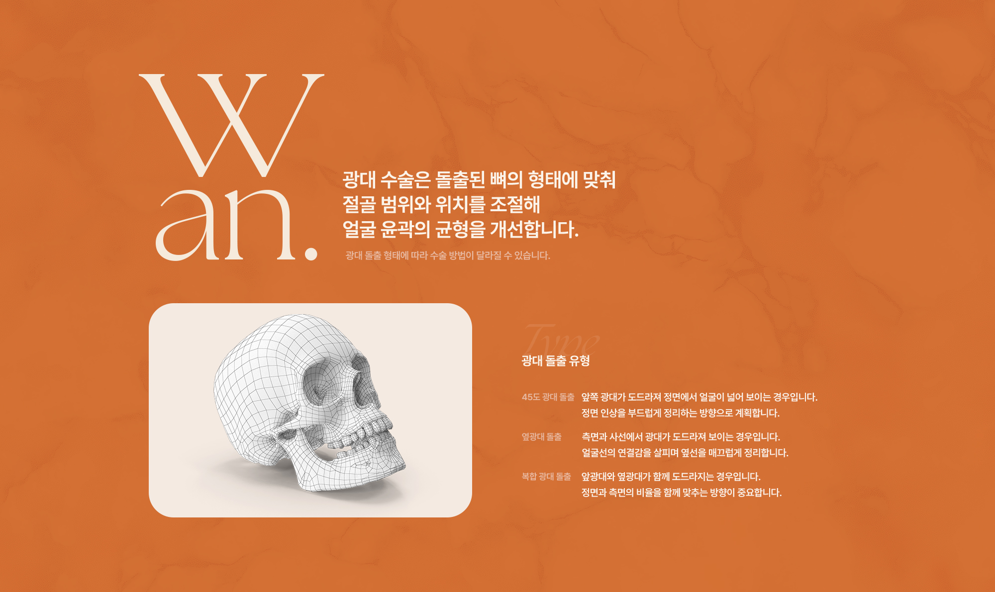 광대수술