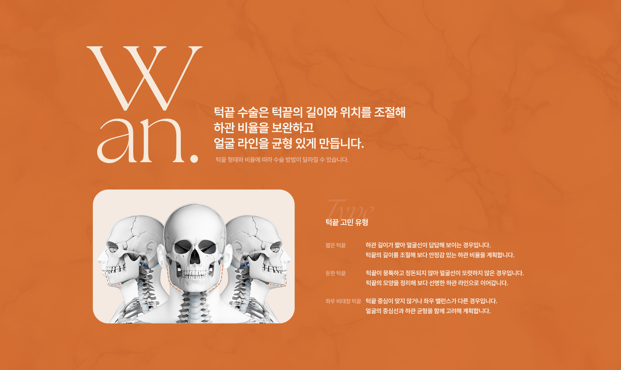 턱끝성형수술
