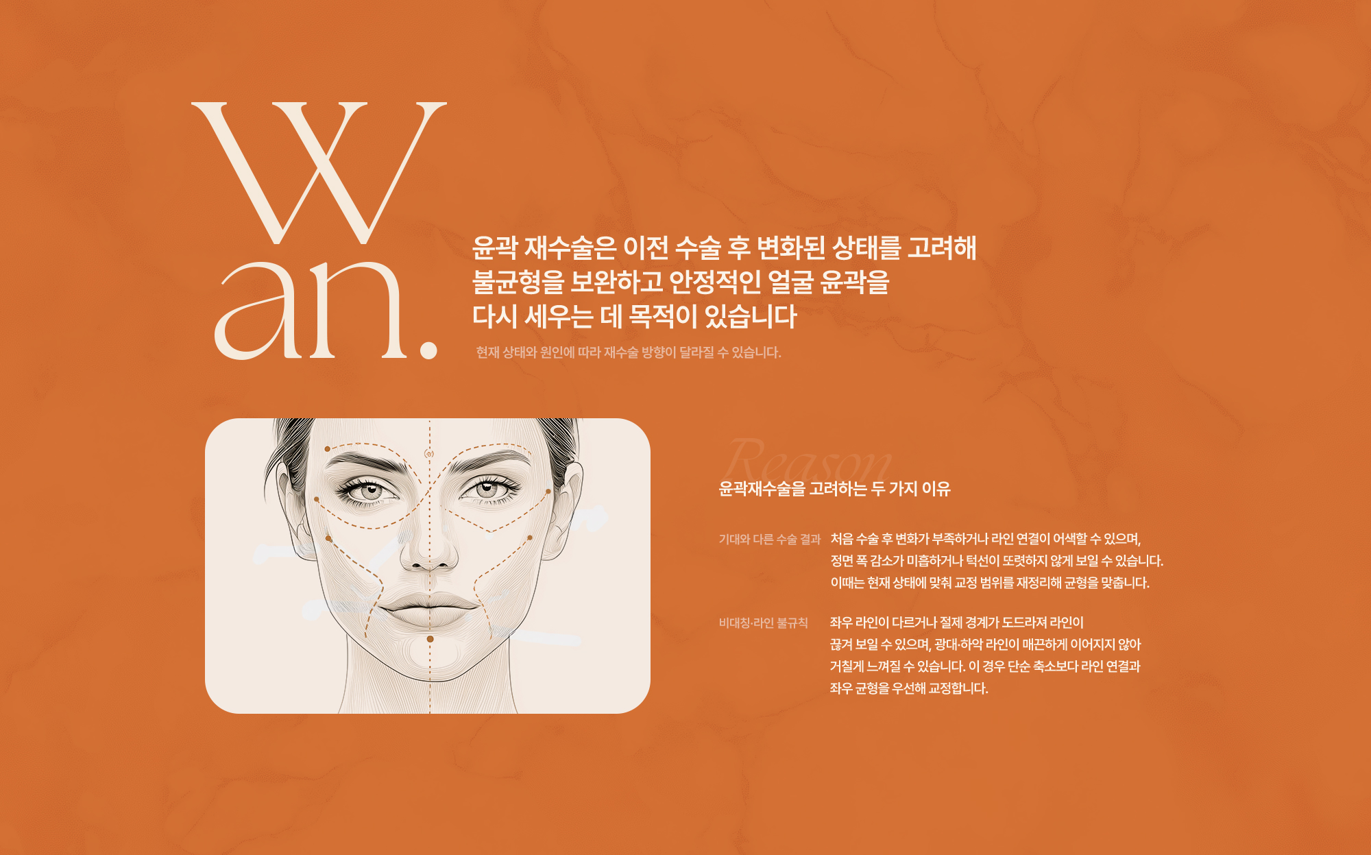 윤곽재수술