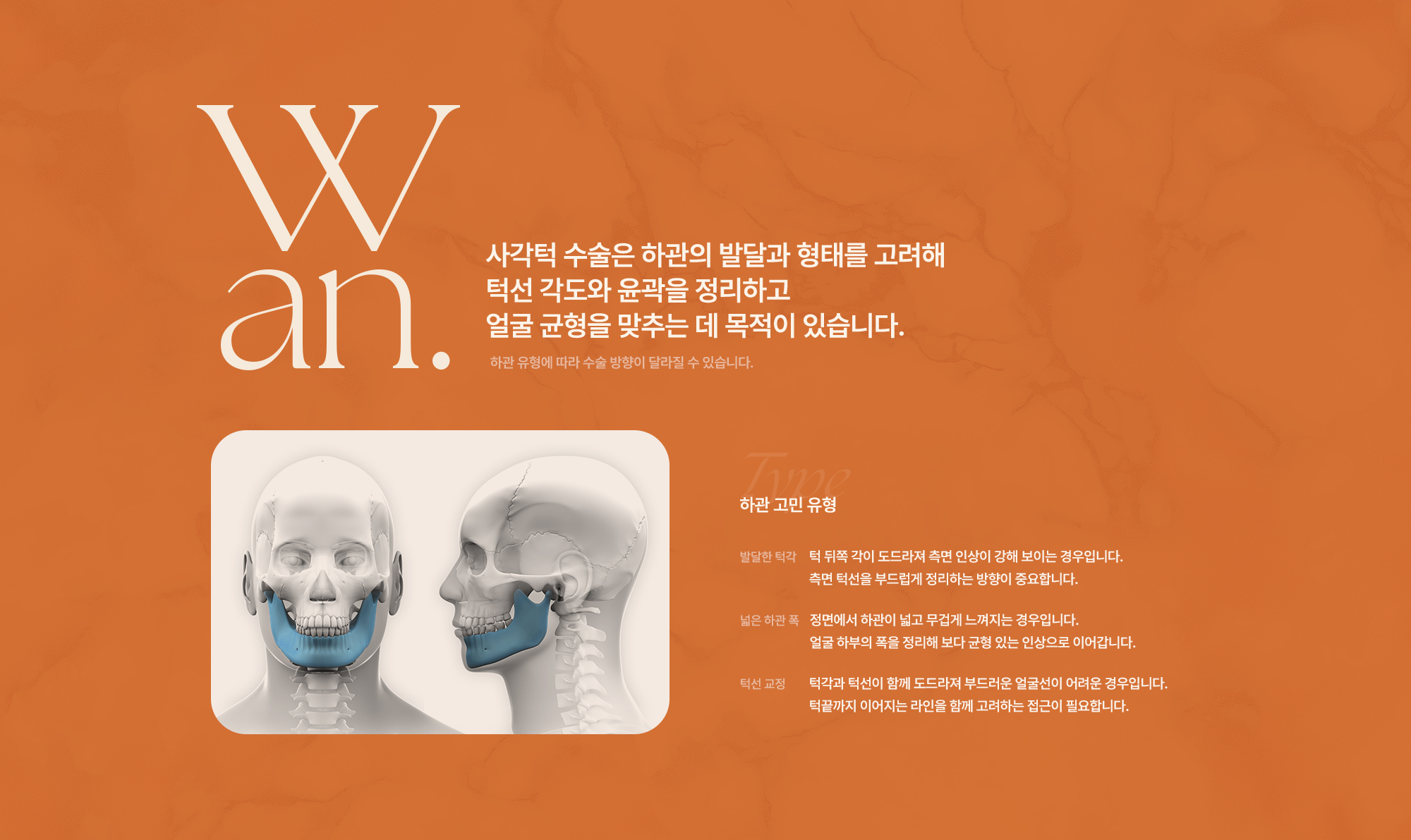 사각턱수술