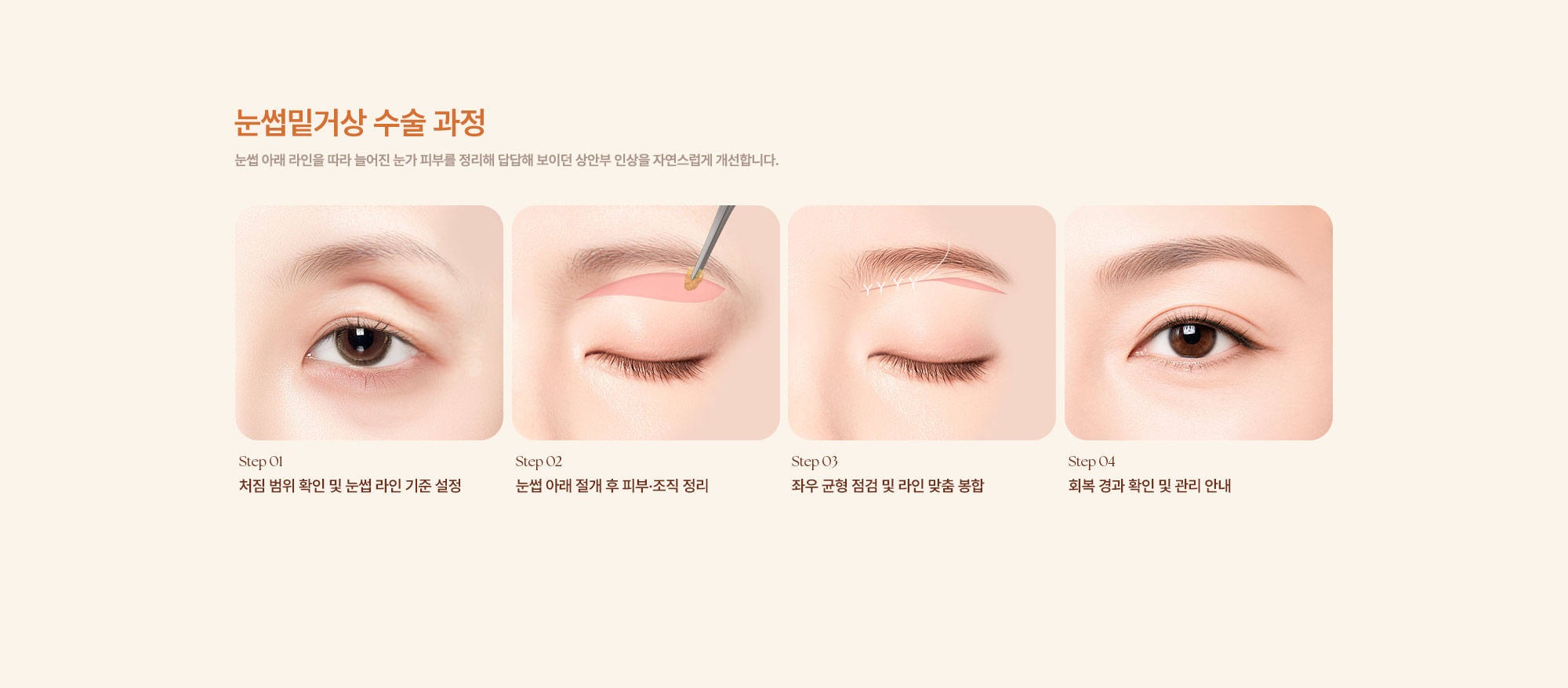 눈썹밑거상