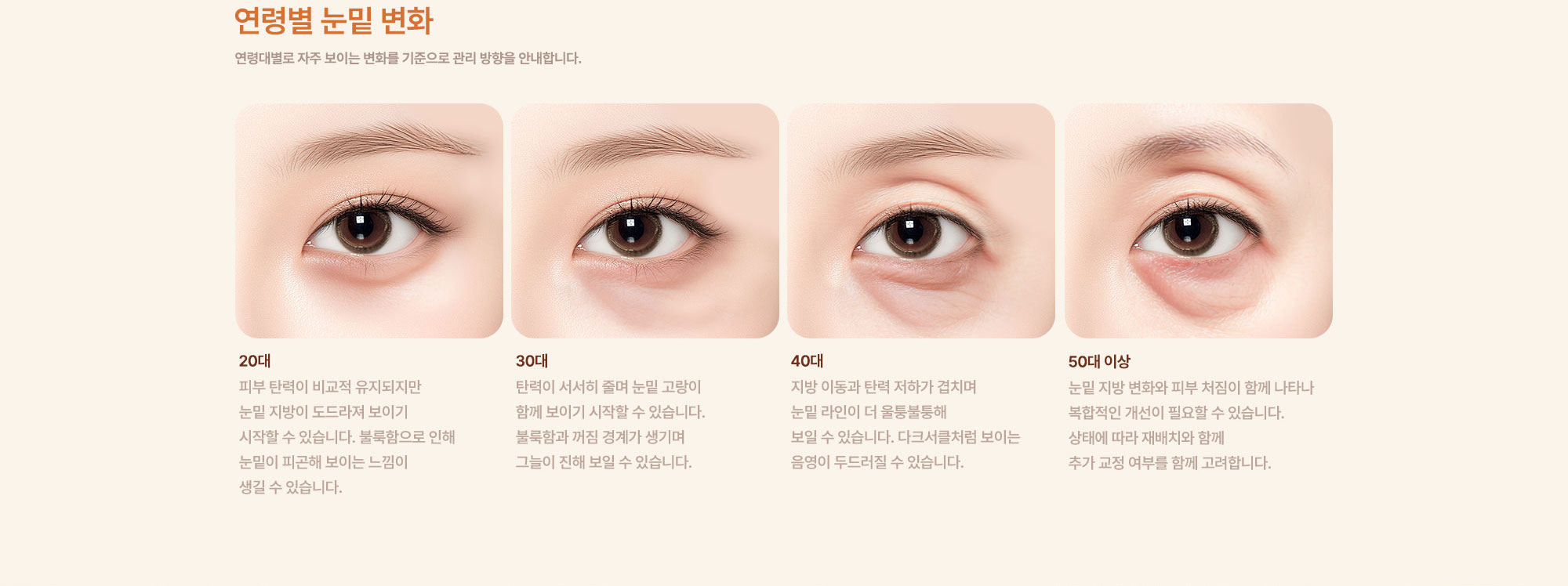 눈밑지방 재배치