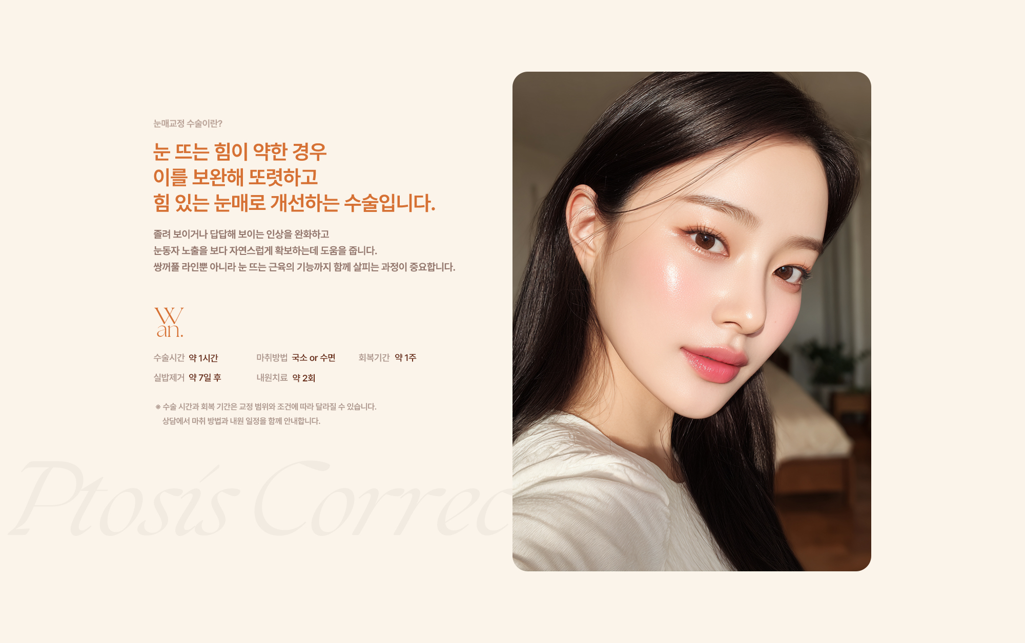 눈매교정수술