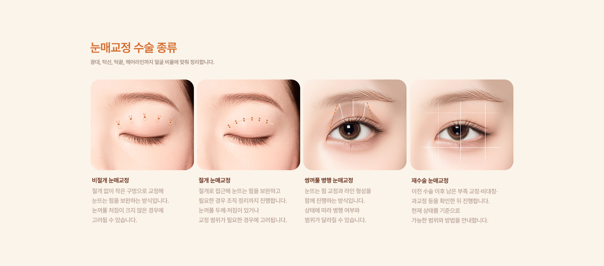 눈매교정수술