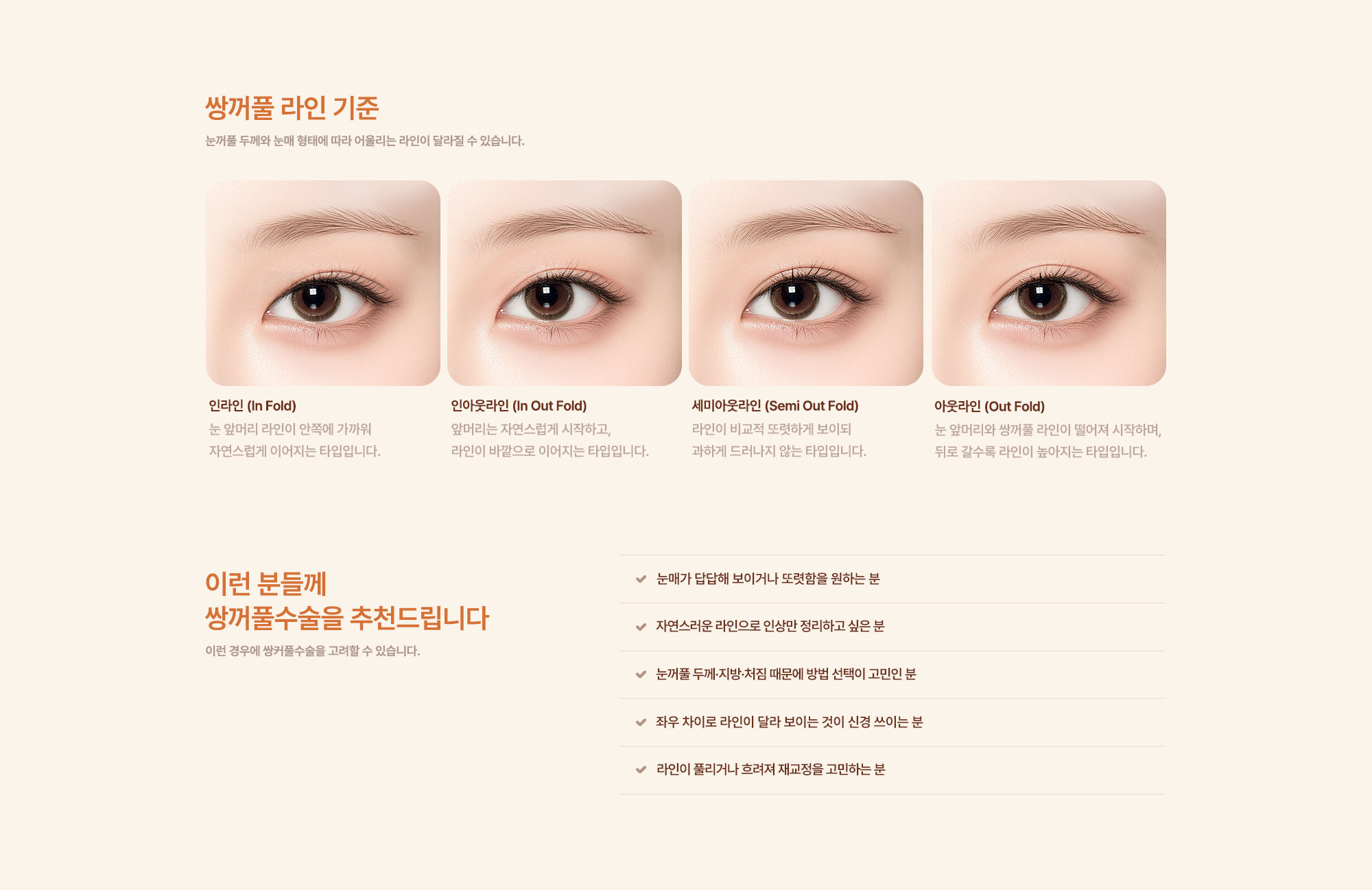 쌍꺼풀 수술