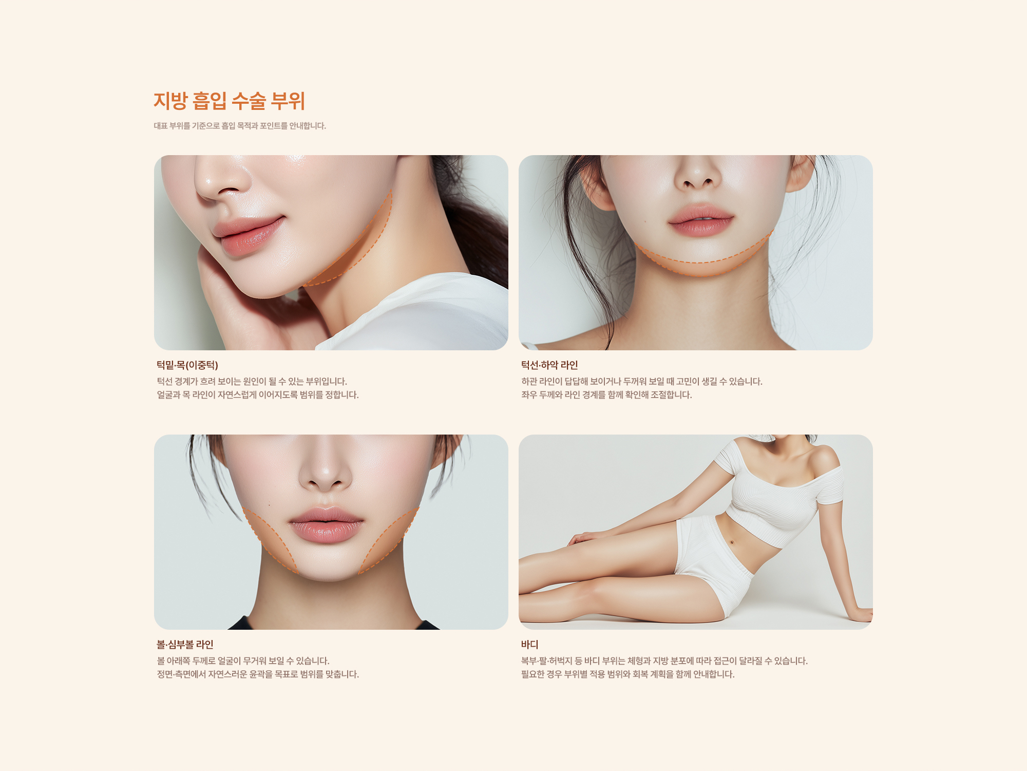 지방흡입