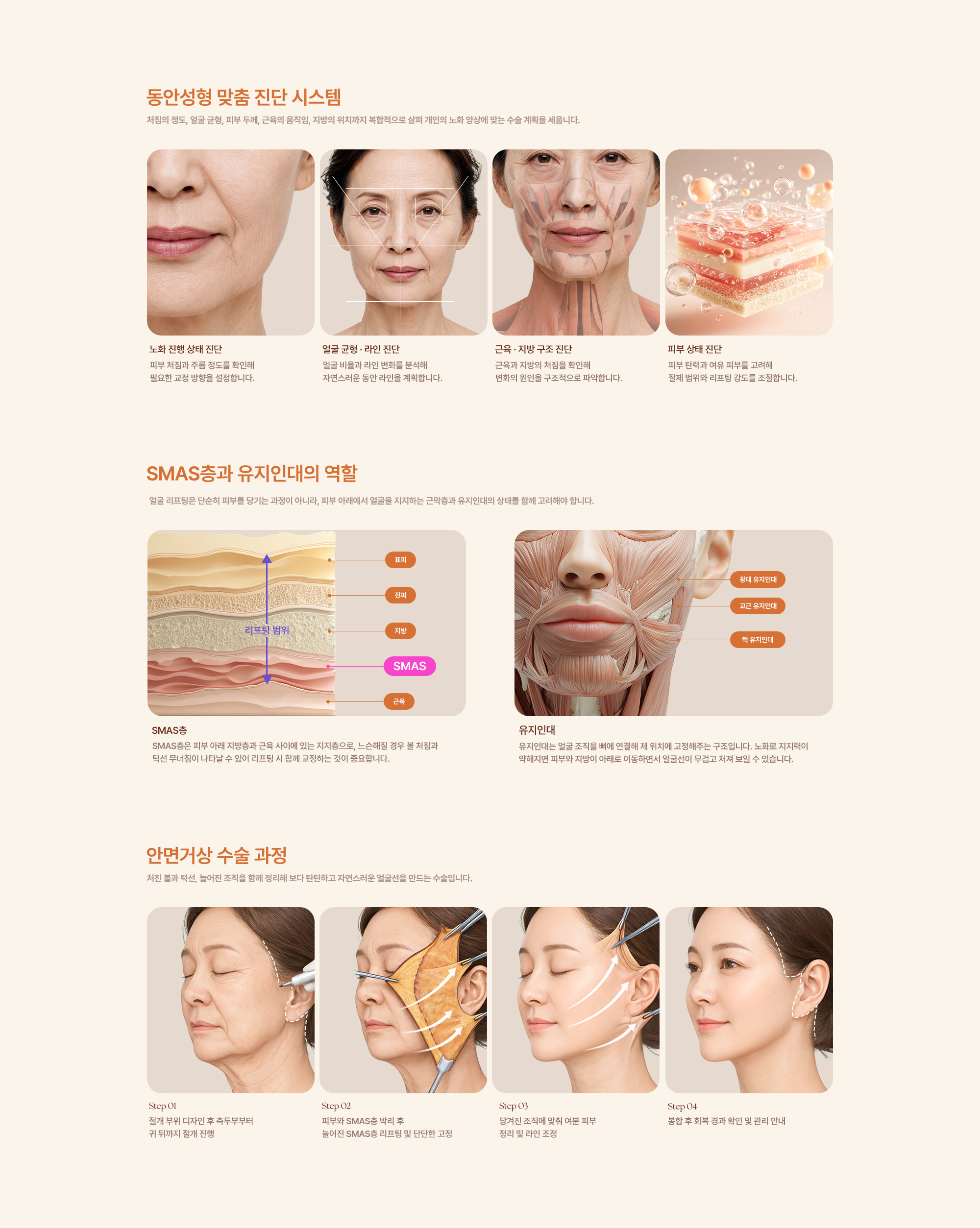 안면거상술