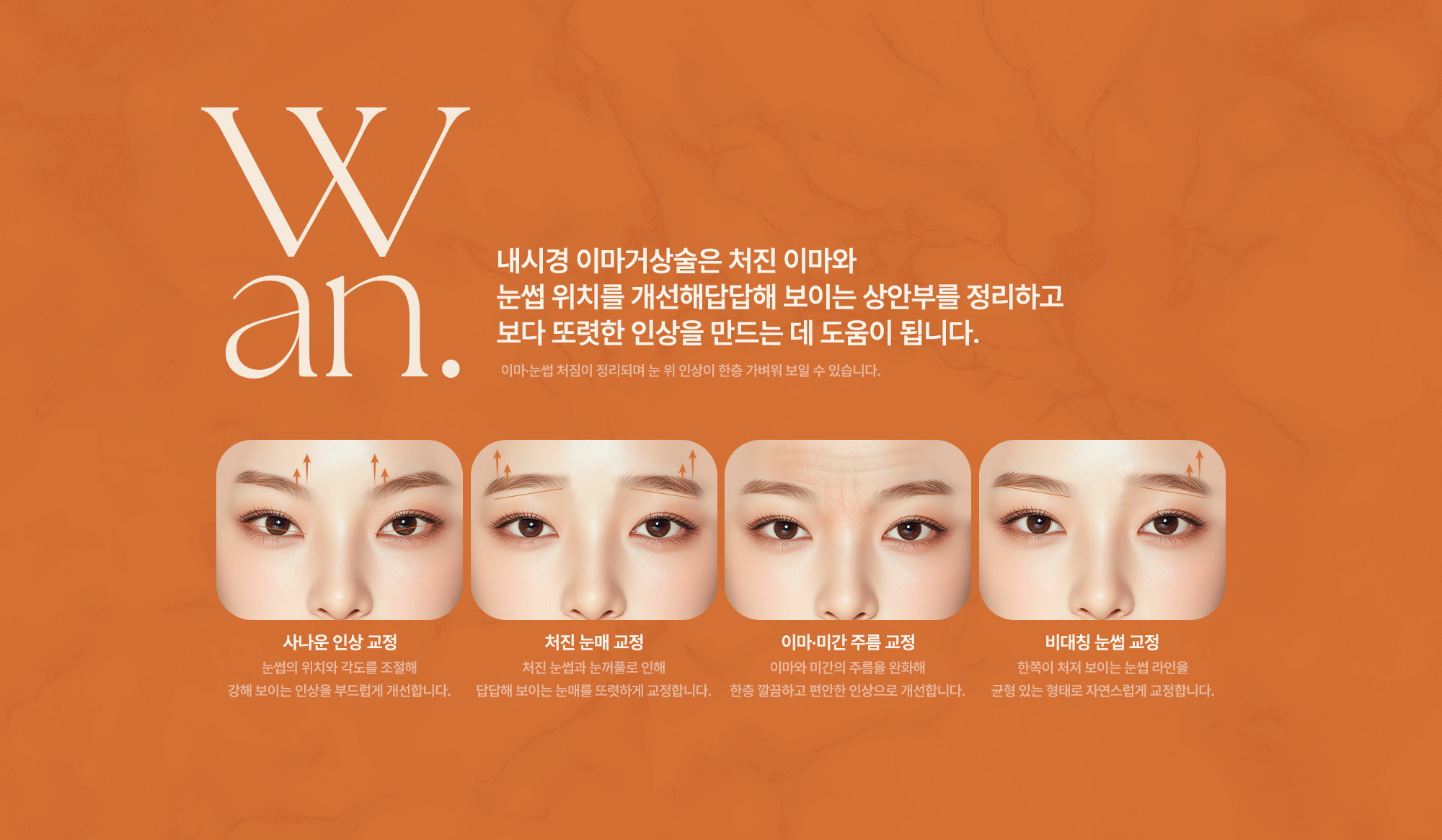 내시경 이마거상술