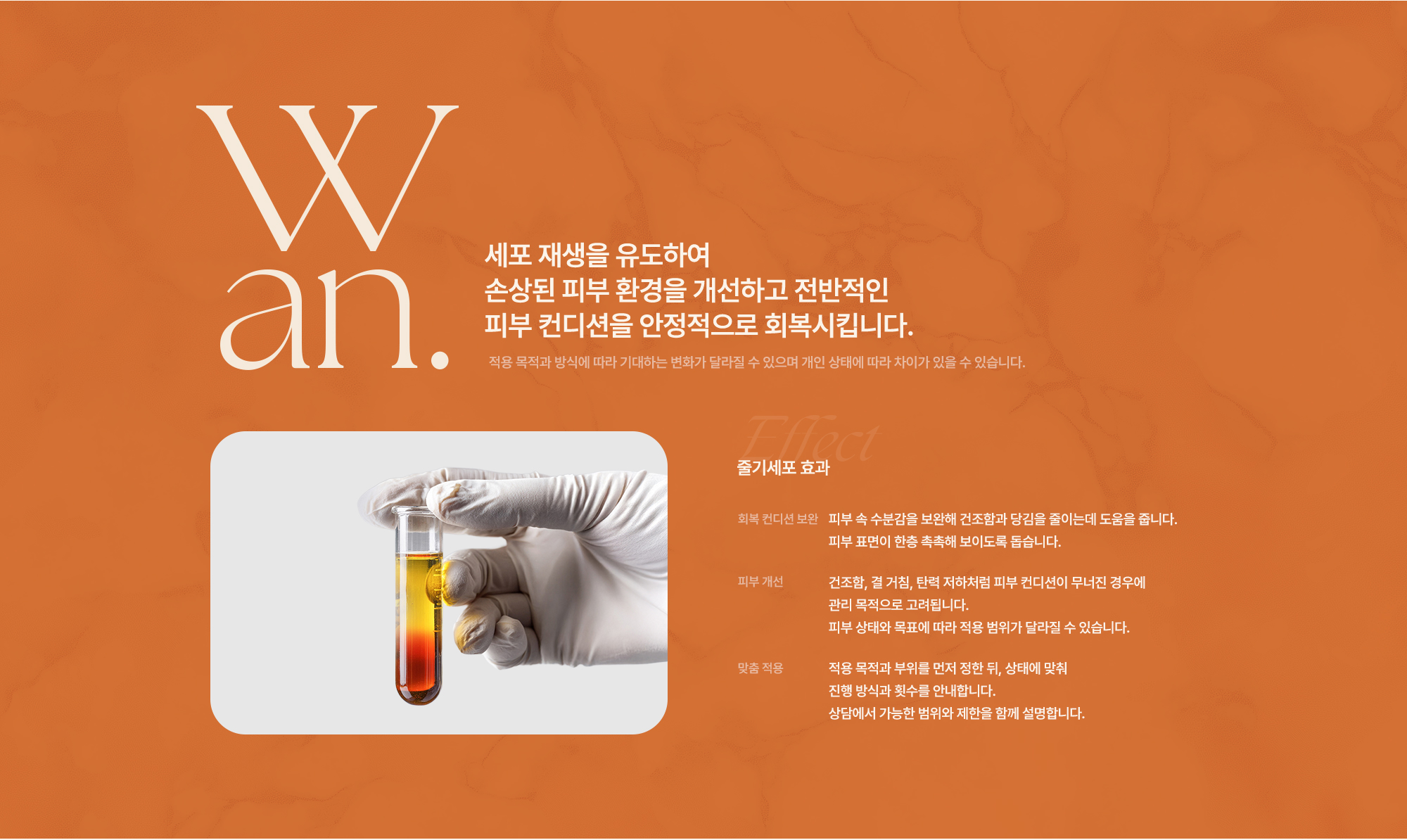 줄기세포