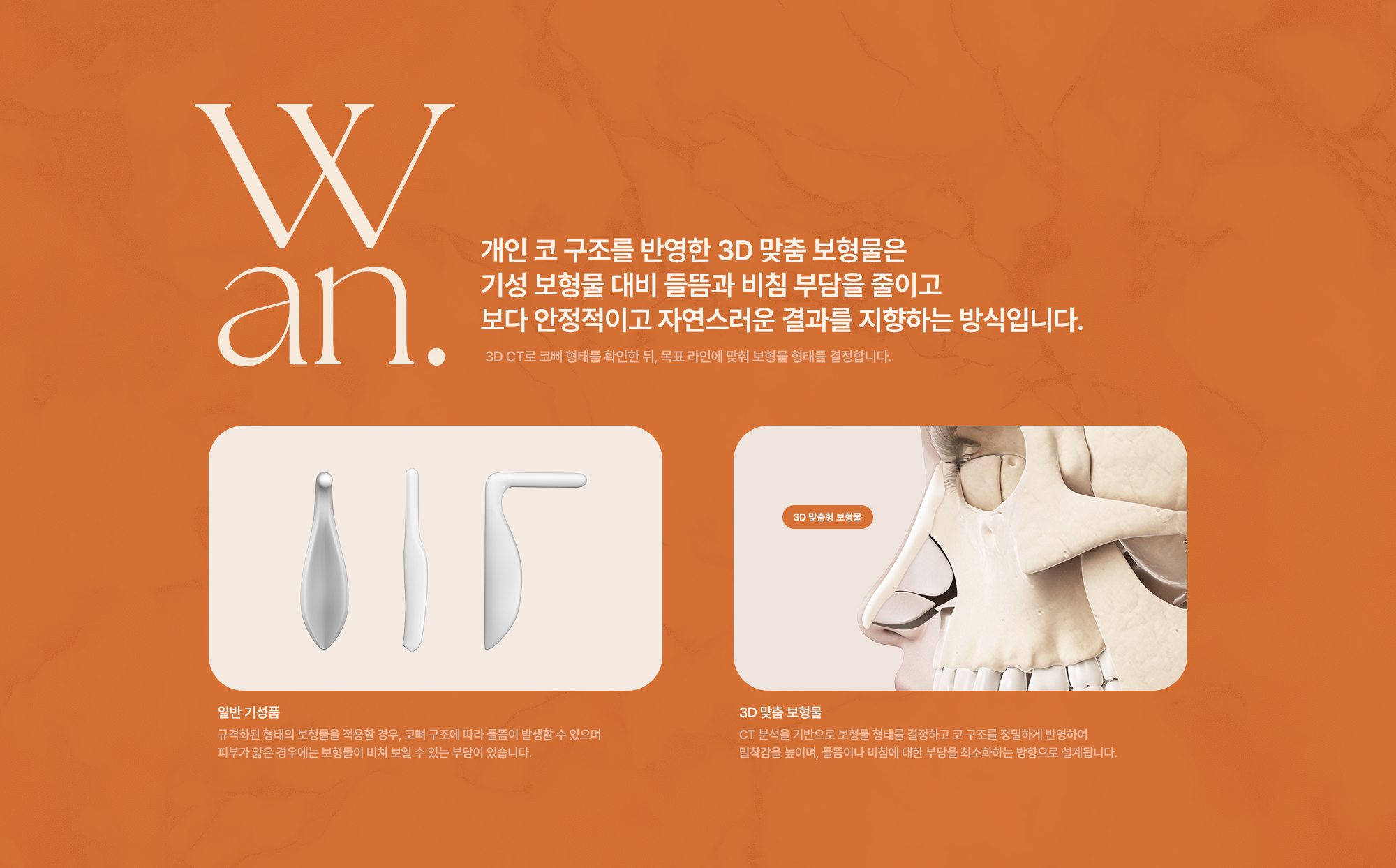 맞춤보형물 코성형