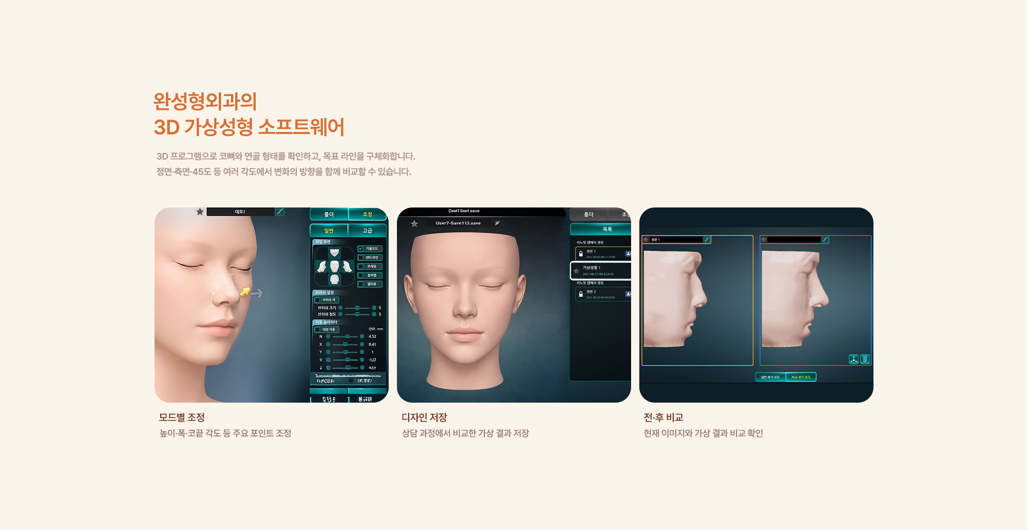 맞춤보형물 코성형