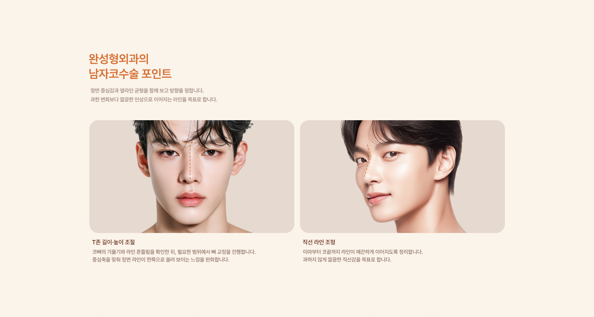 남자코성형