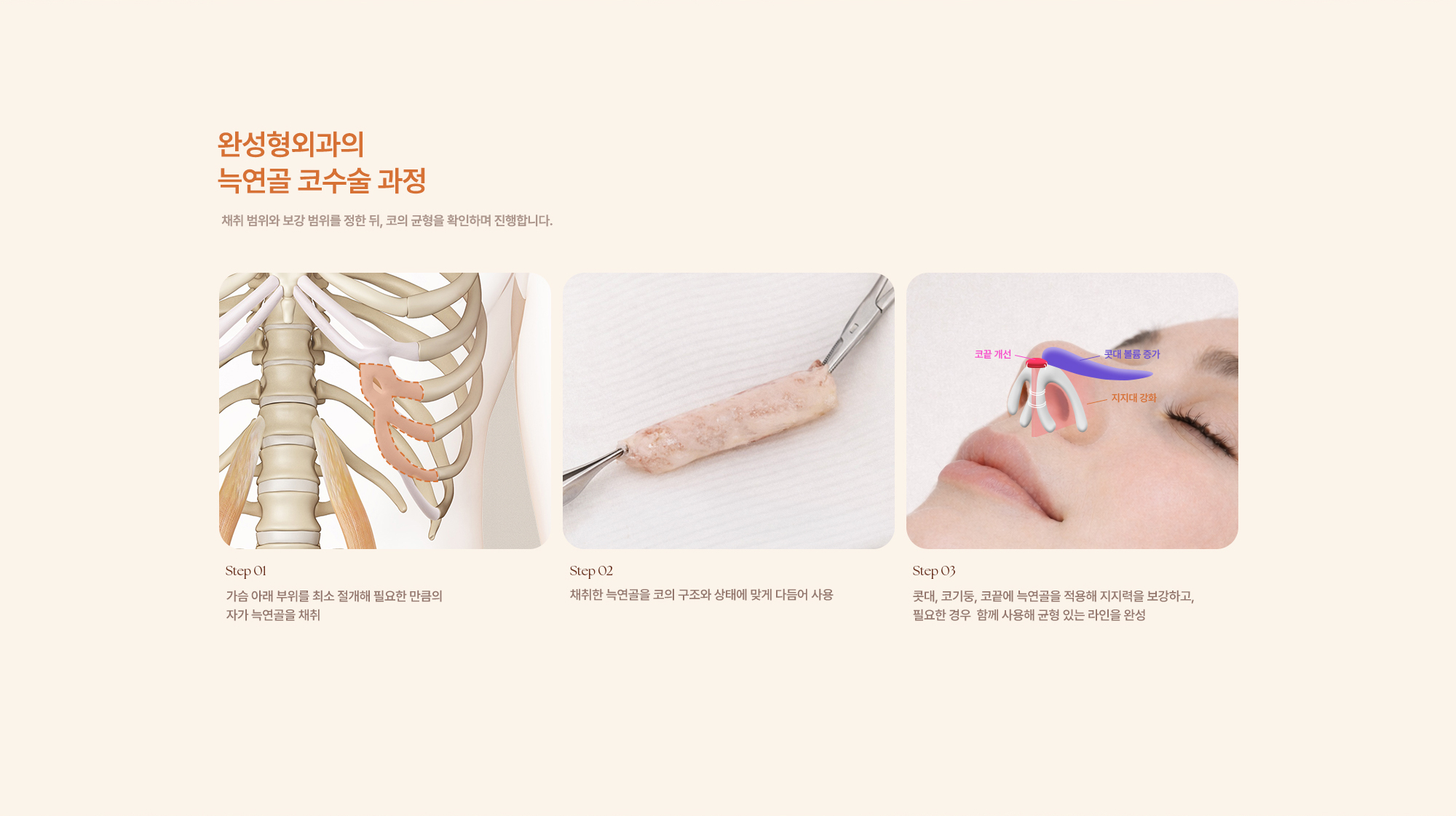 늑연골 코성형